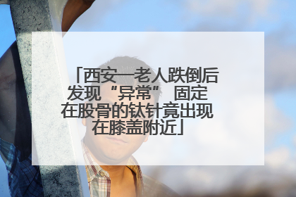 西安一老人跌倒后发现“异常” 固定在股骨的钛针竟出现在膝盖附近